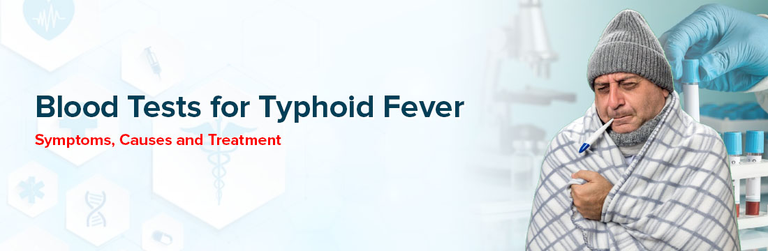 Blood Tests for Typhoid Fever Symptoms Causes and Treatment